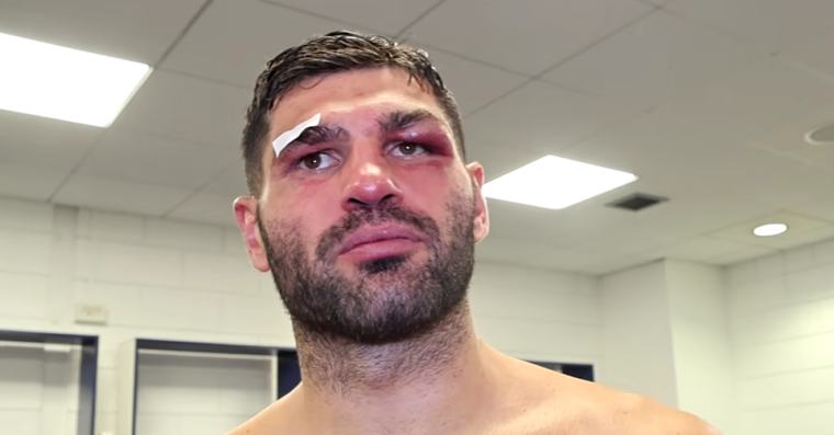 Filip Hrgović nakon čak 163 primljena udarca dobio zabranu boksanja, drugu najdužu u karijeri!
