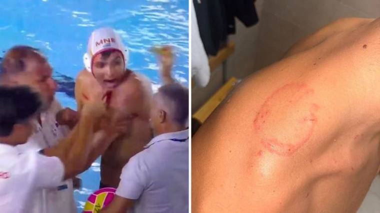 VIDEO Finale vaterpola obilježio skandal! Stupar pokazivao trag ugriza, Savić poludio na suce